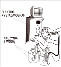 Badanie narządu przedsionkowego bodźcem kalorycznym (próba Hollpike'a)