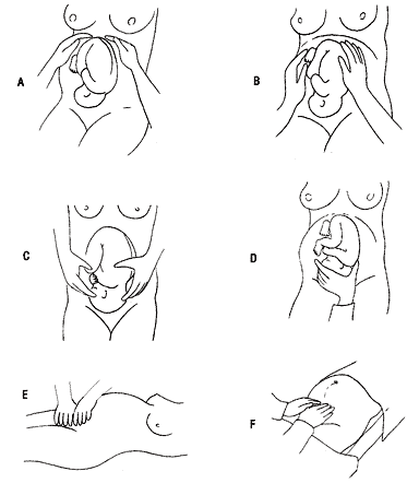 Badanie przedmiotowe zewnętrzne ciężarnej - chwyty Leopolda