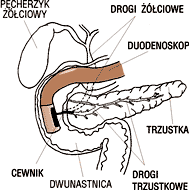 ERCP