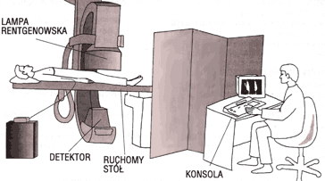 Schemat badania arteriograficznego