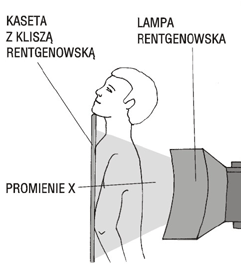 Schemat wykonania standardowego zdjęcia rentgenowskiego (RTG) klatki piersiowej