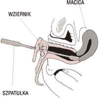 Techniki uzyskiwania materiału
cytologicznego - pobranie wymazu z szyjki macicy