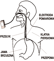 Schemat badania pH-metrycznego przełyku