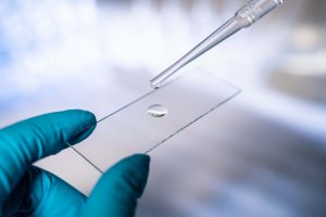 biopsja prostaty